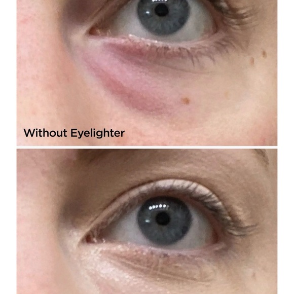 BeautyBio Eyelighter Concentrate Smoothing, Brightening Serum & Depuffing Tool - Picture 7 of 12